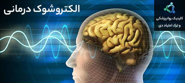 فواید الکتروشوک درمانی