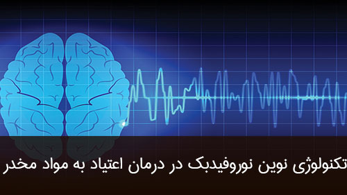 تکنولوژی نوین نوروفیدبک در درمان اعتیاد به مواد مخدر