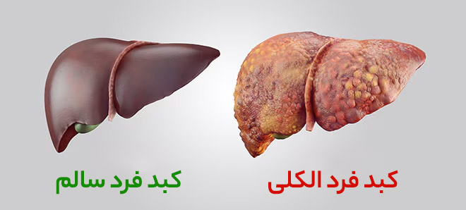 عوارض و اختلالات نوشیدن الکل