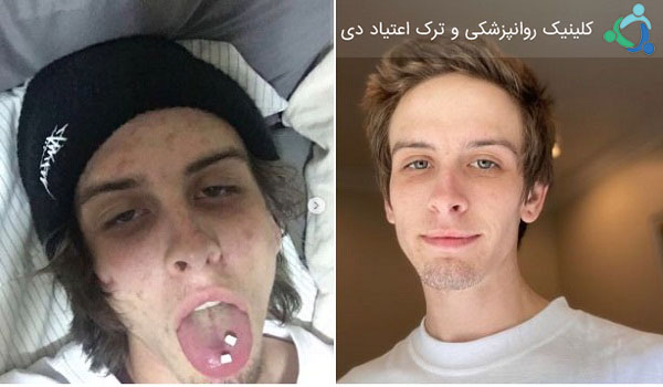 تغییرات جسمانی ناشی از ترک مواد مخدر