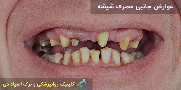 عوارض مصرف شیشه