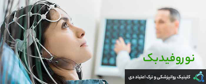 نوروفیدبک