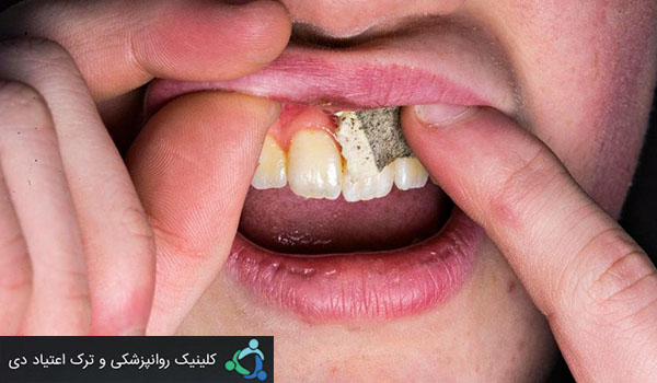 ضرورت مراقبت مستمر از فرزندان در مقابل مواد مخدر