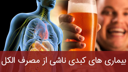 بیماری های کبدی ناشی از مصرف الکل
